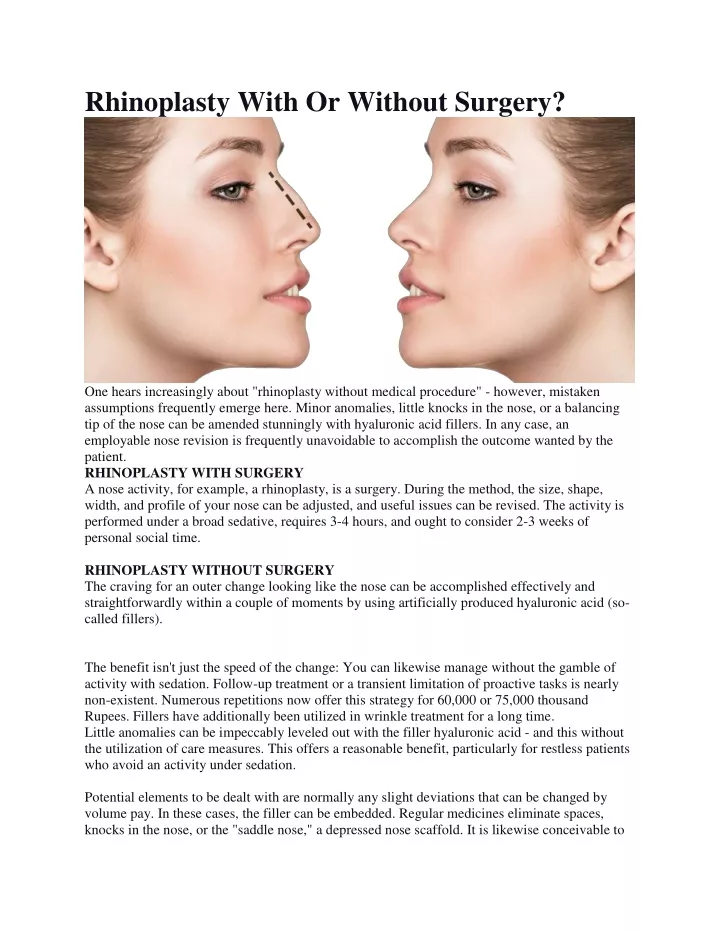 rhinoplasty with or without surgery