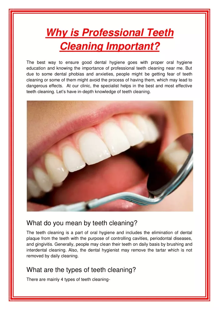 why is professional teeth cleaning important