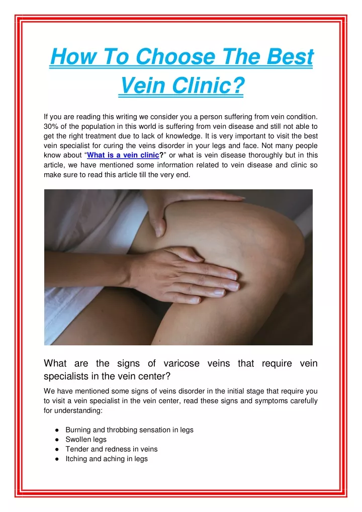 how to choose the best vein clinic