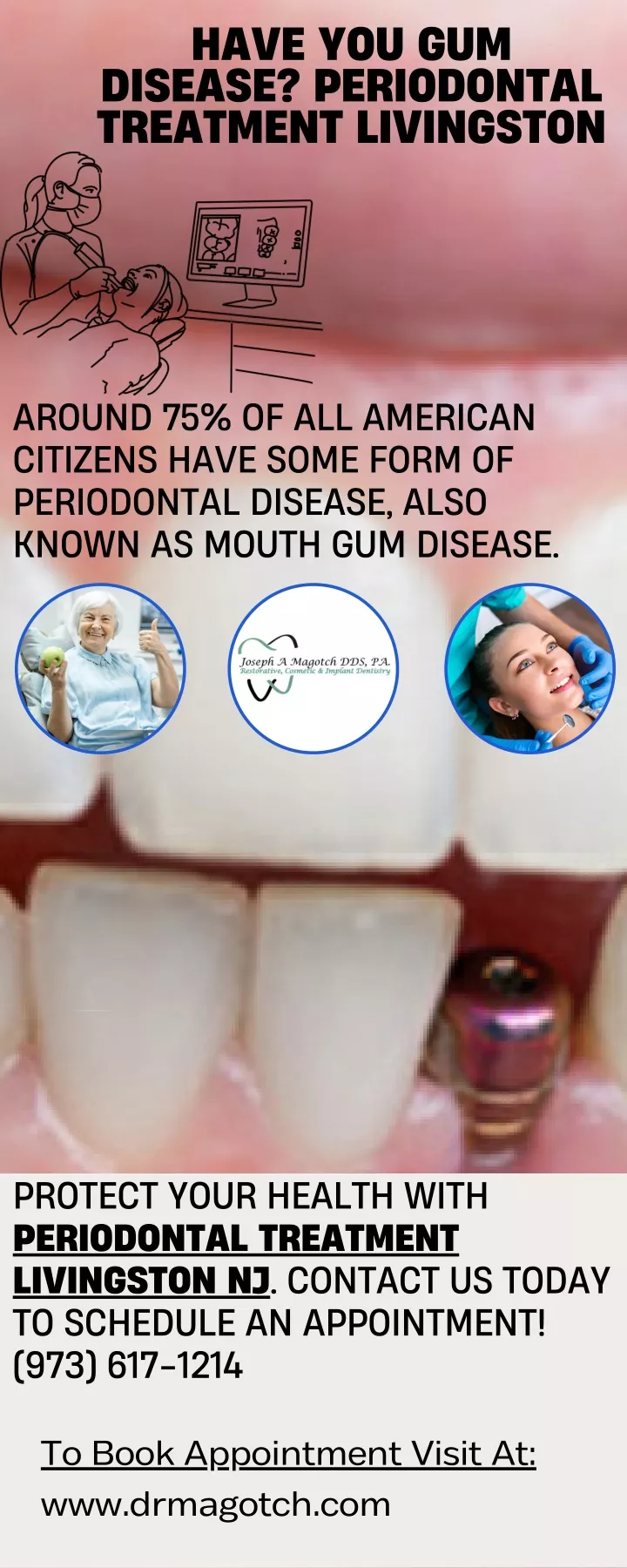 have you gum disease periodontal treatment