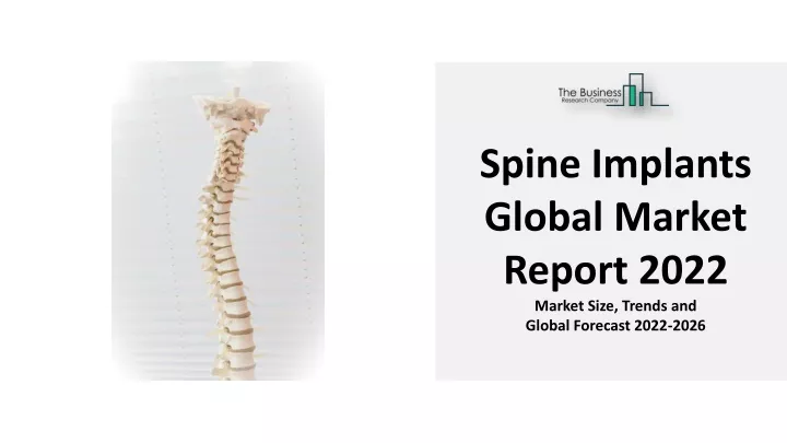 spine implants global market report 2022 market