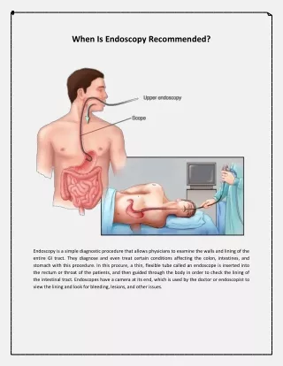 When is Endoscopy Recommended?