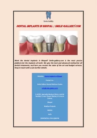 dental implants in bhopal smile dental implants