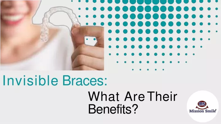 invisible braces what are their benefits