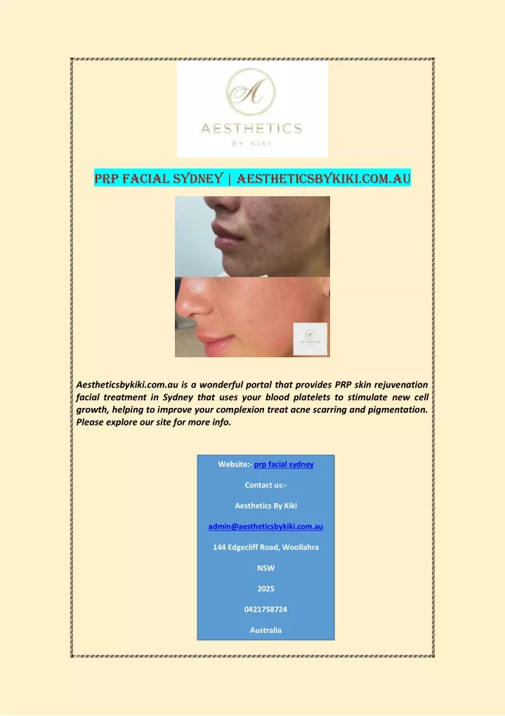 prp facial sydney aestheticsbykiki com au