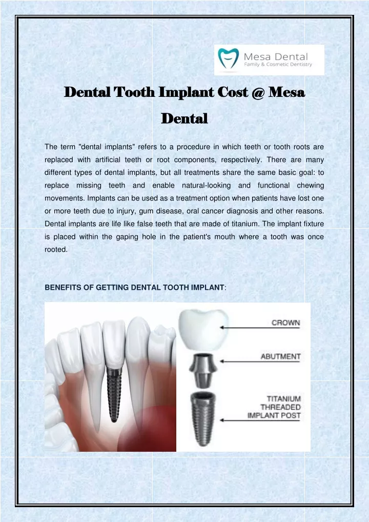 dental tooth implant cost @ mesa dental tooth