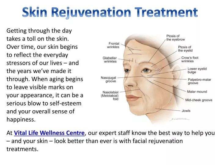 skin rejuvenation treatment