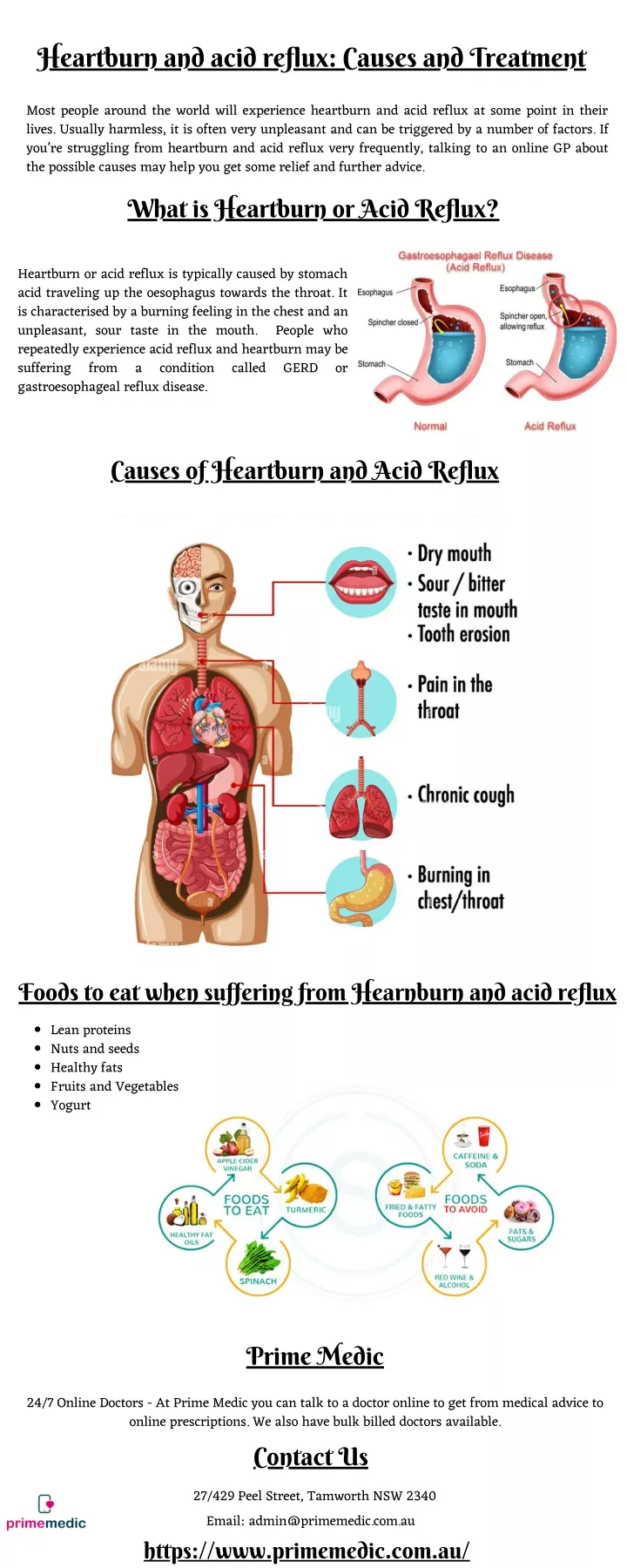heartburn and acid reflux causes and treatment