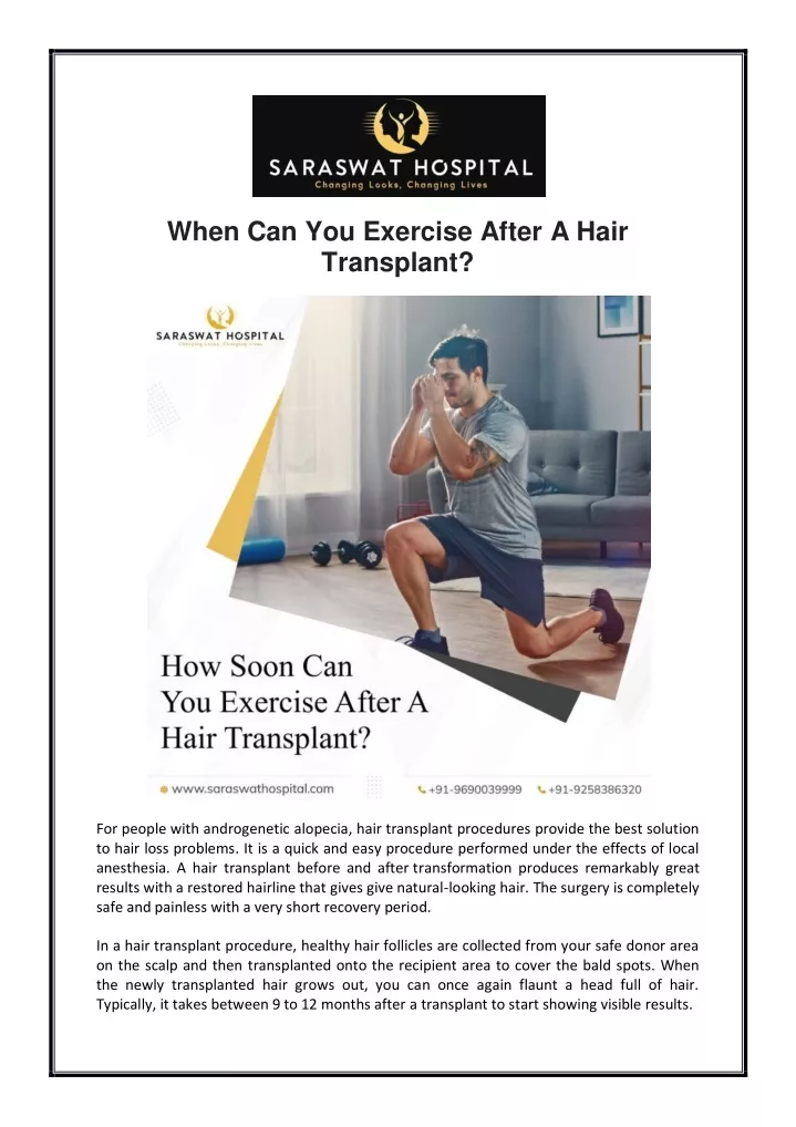 when can you exercise after a hair transplant