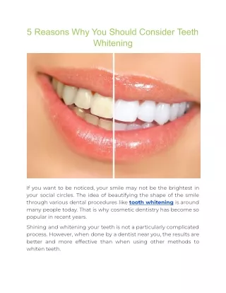 5 reasons why you should consider teeth whitening