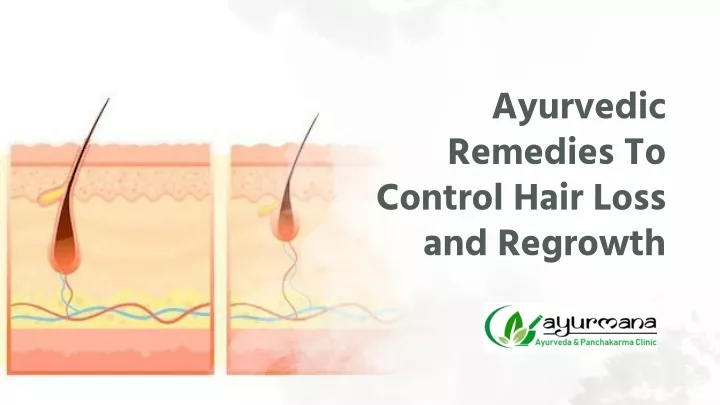 ayurvedic remedies to control hair loss