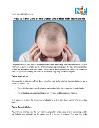 How to Take Care of the Donor Area after Hair Transplants
