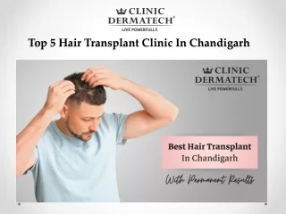 Top 5 Hair Transplant Clinic In Chandigarh