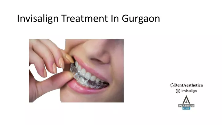 invisalign treatment in gurgaon