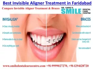 best invisible aligner treatment in faridabad