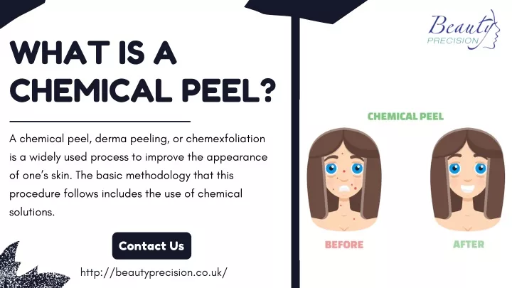 what is a chemical peel