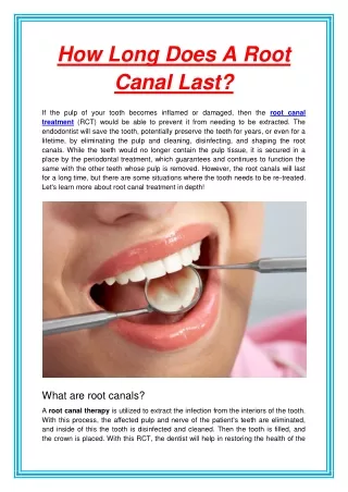 how long does a root canal last