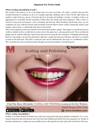 Scaling & Polishing Of Teeth-1