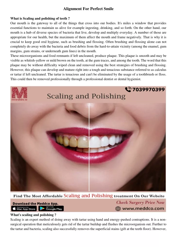 alignment for perfect smile