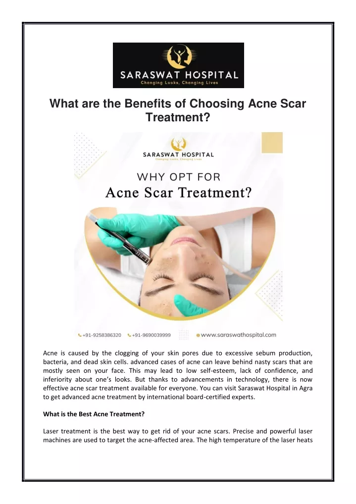 what are the benefits of choosing acne scar