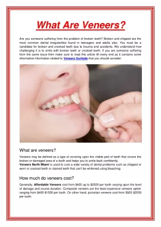what are veneers