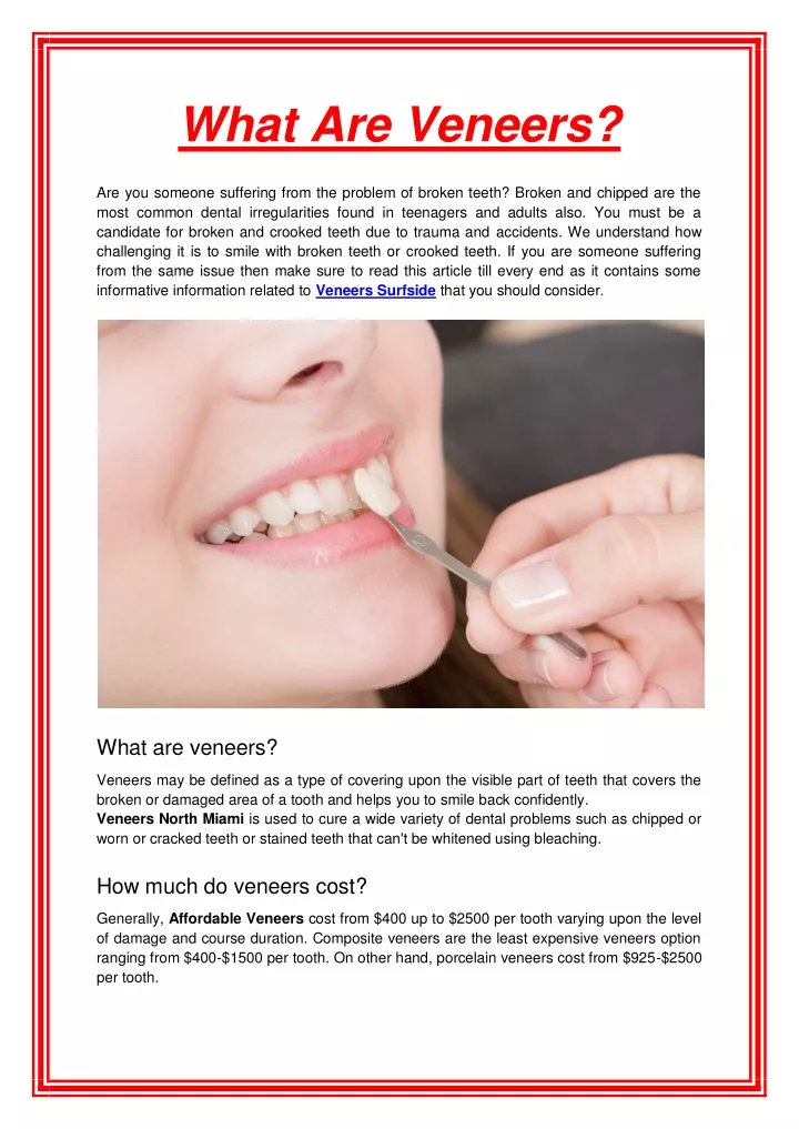 what are veneers