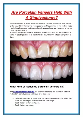 are porcelain veneers help with a gingivectomy