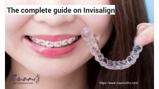 The complete guide on Invisalign - Invisible Braces