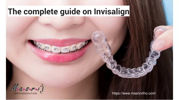the complete guide on invisalign