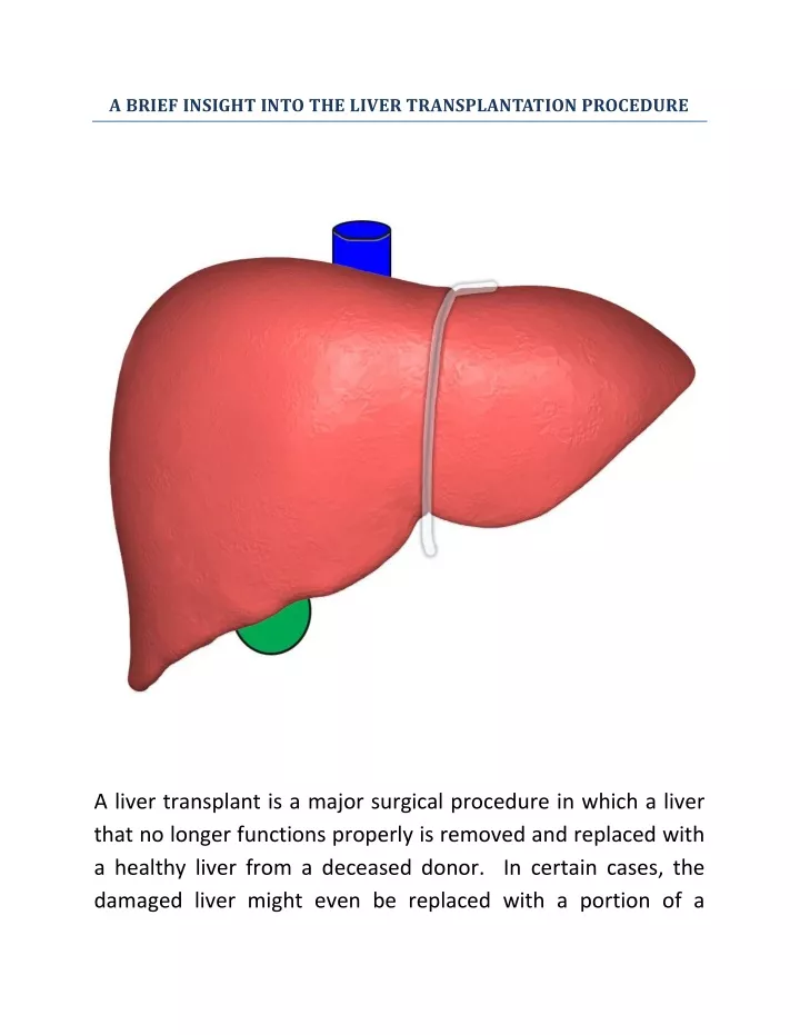 a brief insight into the liver transplantation