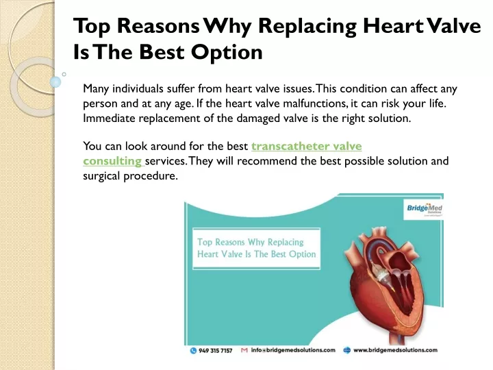top reasons why replacing heart valve is the best