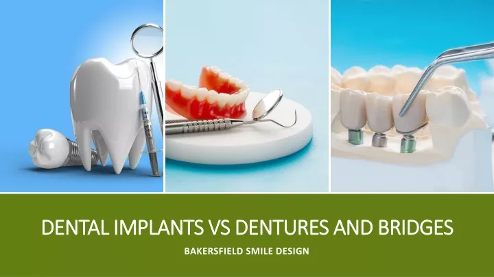 dental implants vs dentures and bridges