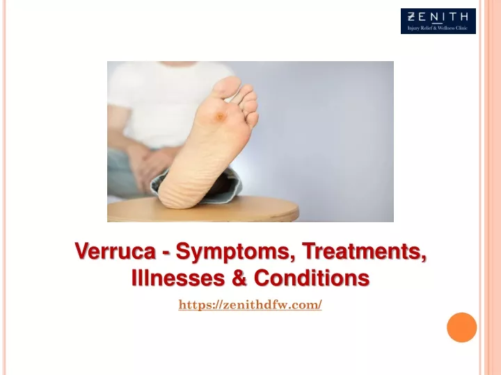 verruca symptoms treatments illnesses conditions