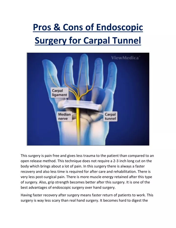 pros cons of endoscopic surgery for carpal tunnel