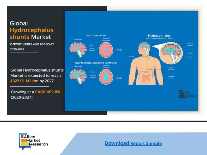 download report sample