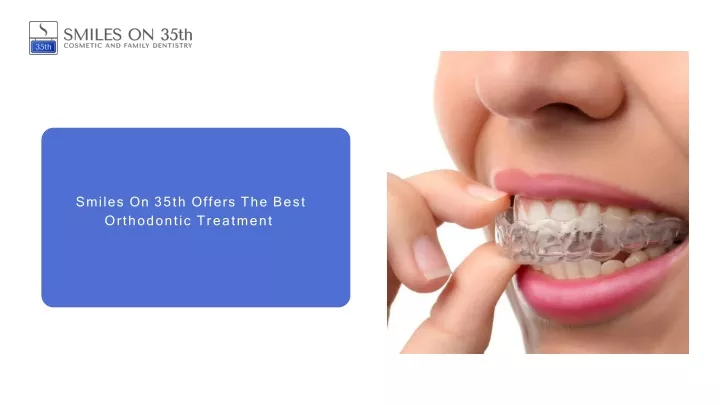 smiles on 35th offers the best orthodontic