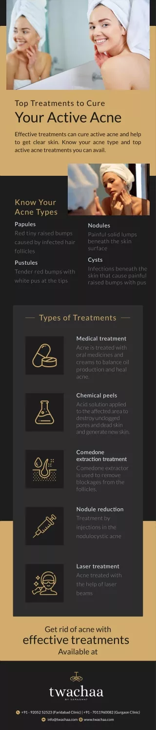 Top Treatments to Cure Your Active Acne