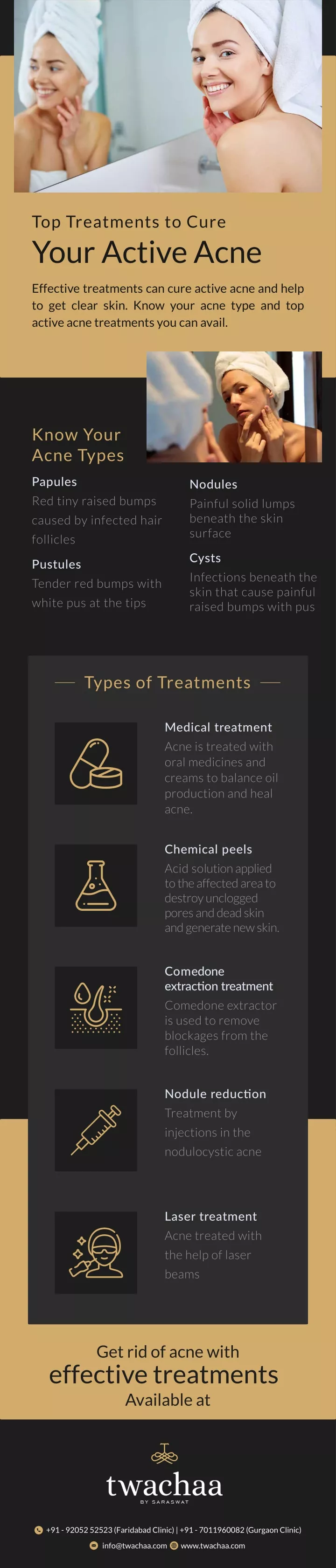 top treatments to cure your active acne