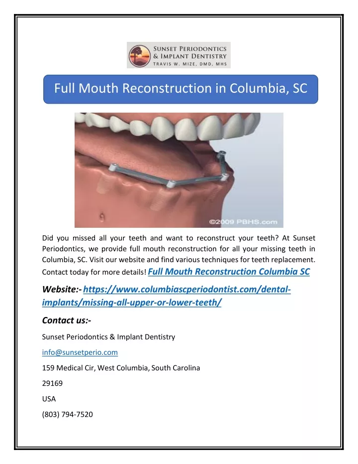 full mouth reconstruction in columbia sc