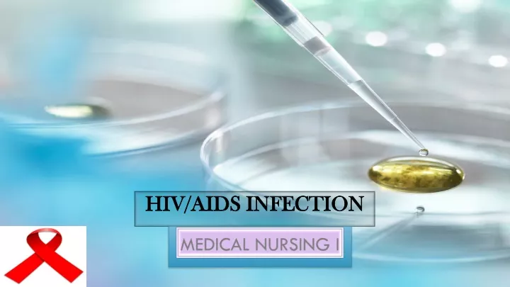 hiv aids infection