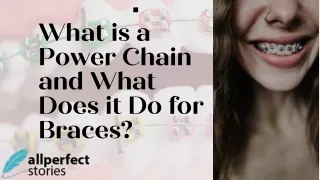 What is a Power Chain and What Does it Do for Braces