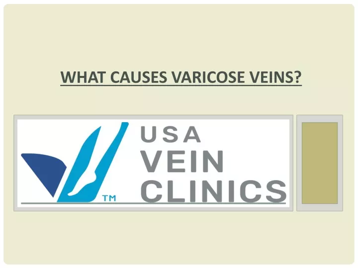 what causes varicose veins