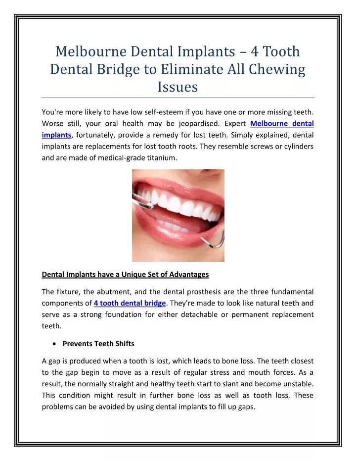 melbourne dental implants 4 tooth dental bridge