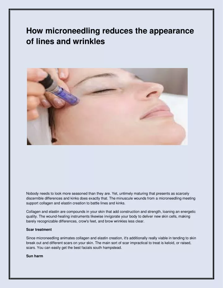 how microneedling reduces the appearance of lines