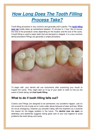 how long does the tooth filling process take