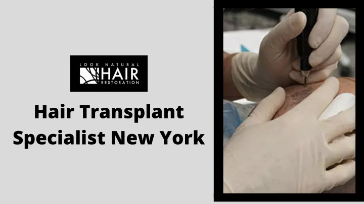 hair transplant specialist new york