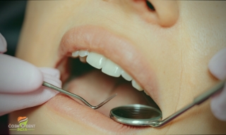 Solutions For Best Dental Clinic in Bangalore