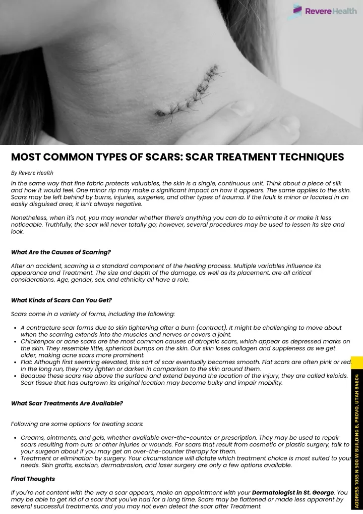 most common types of scars scar treatment