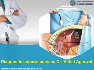 Diagnostic Laparoscopy by Dr. Achal Agarwal. Call:  91-9171770805