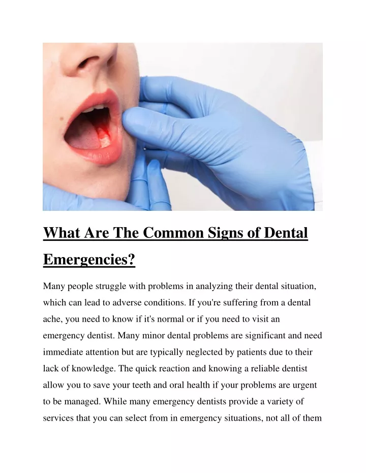 what are the common signs of dental